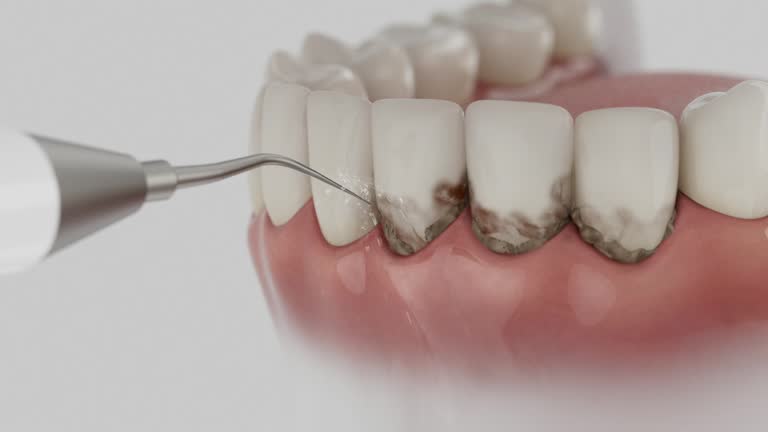 Trusted Dental Implants service in Pleasure Point, CA - Dentist Open Now